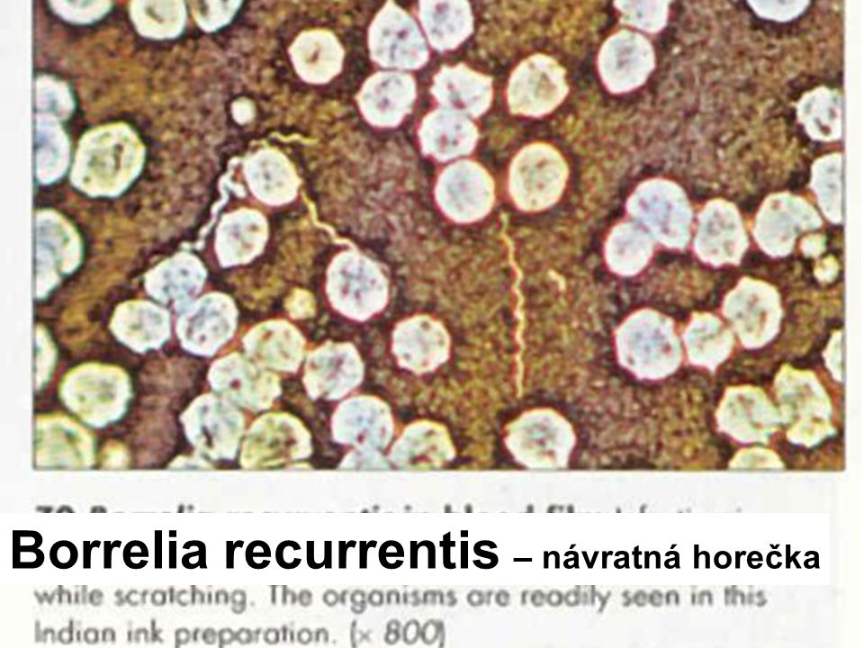 Borrelia recurrentis – návratná horečka