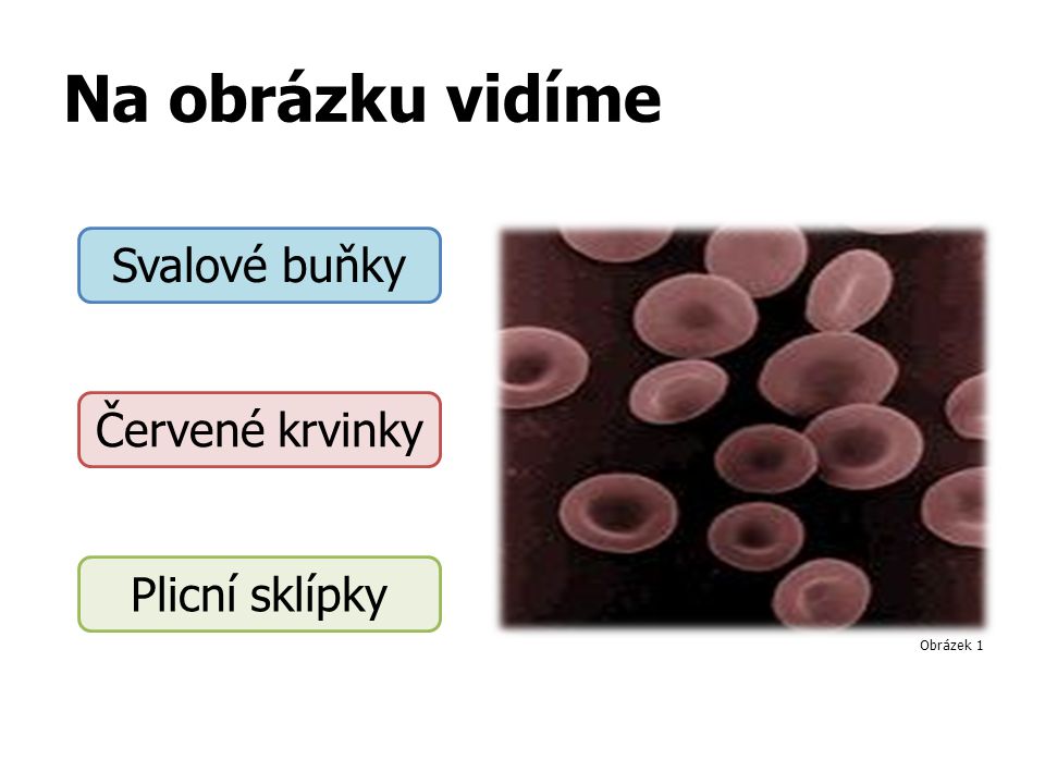 Na obrázku vidíme Svalové buňky Červené krvinky Plicní sklípky