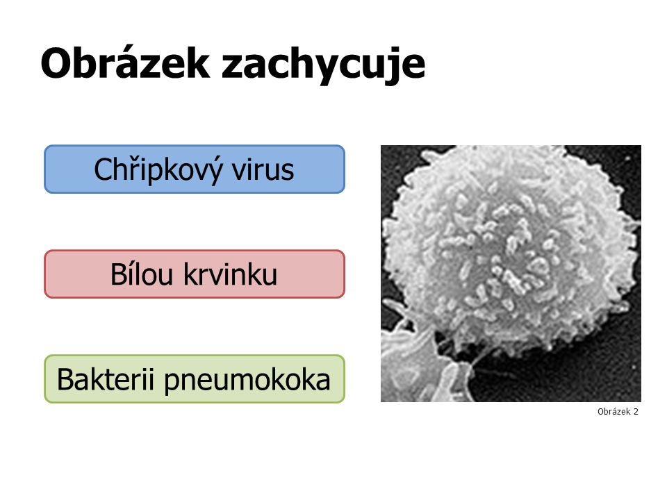 Obrázek zachycuje Chřipkový virus Bílou krvinku Bakterii pneumokoka