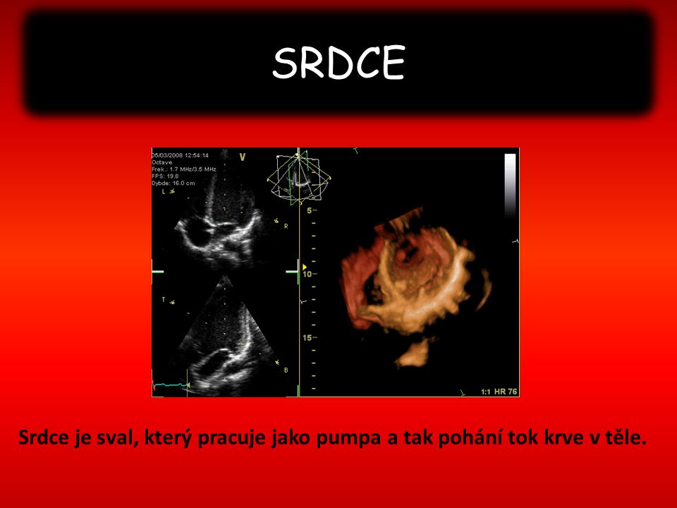 SRDCE Srdce je sval, který pracuje jako pumpa a tak pohání tok krve v těle.