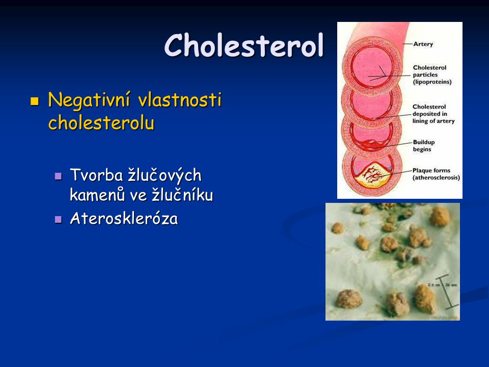 Cholesterol Negativní vlastnosti cholesterolu