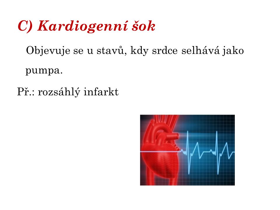 C) Kardiogenní šok Objevuje se u stavů, kdy srdce selhává jako pumpa.