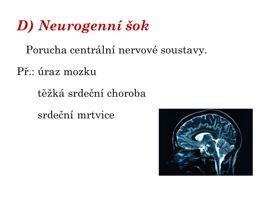 D) Neurogenní šok Porucha centrální nervové soustavy. Př.: úraz mozku