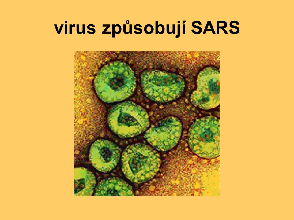 virus způsobují SARS