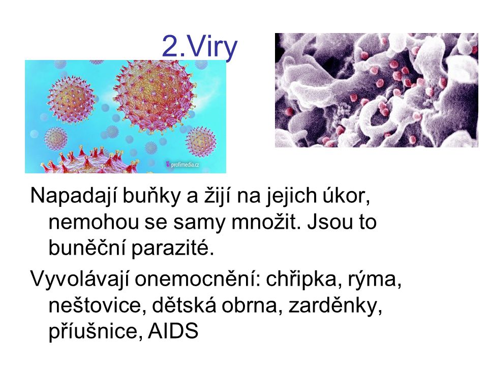 2.Viry Napadají buňky a žijí na jejich úkor, nemohou se samy množit. Jsou to buněční parazité.