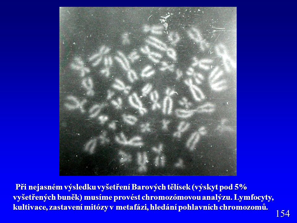 Při nejasném výsledku vyšetření Barových tělísek (výskyt pod 5% vyšetřených buněk) musíme provést chromozómovou analýzu. Lymfocyty, kultivace, zastavení mitózy v metafázi, hledání pohlavních chromozomů.