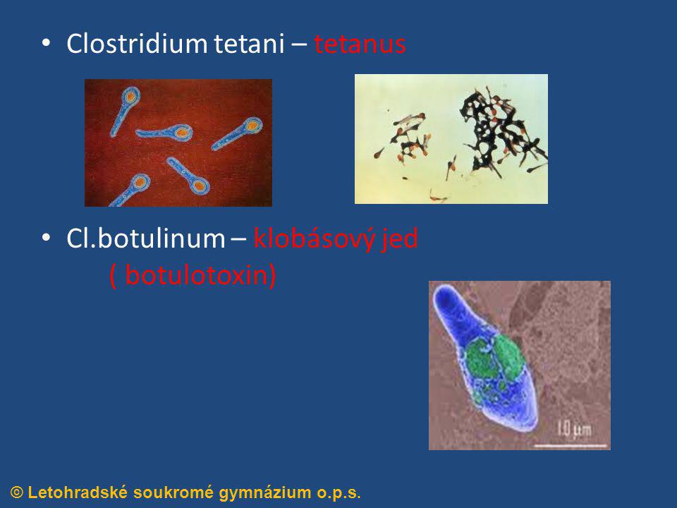 Clostridium tetani – tetanus
