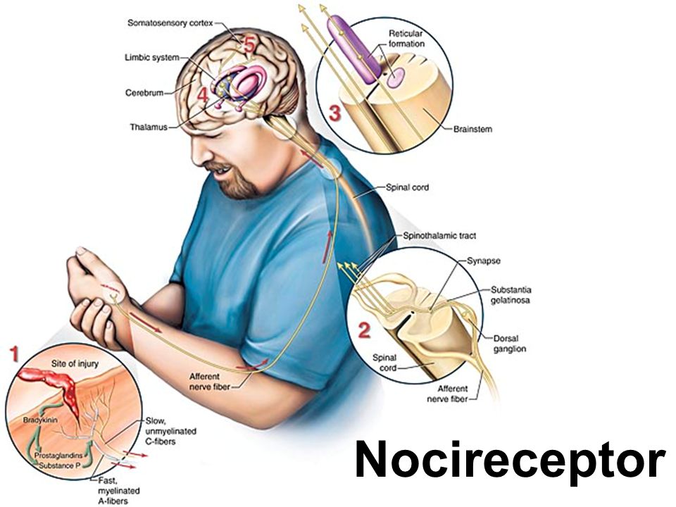 Nocireceptor