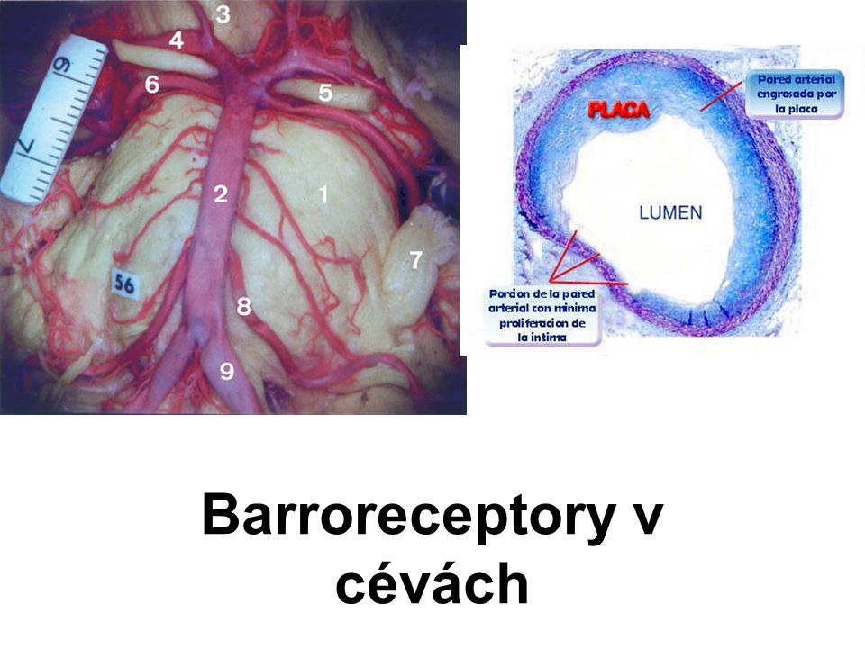 Barroreceptory v cévách