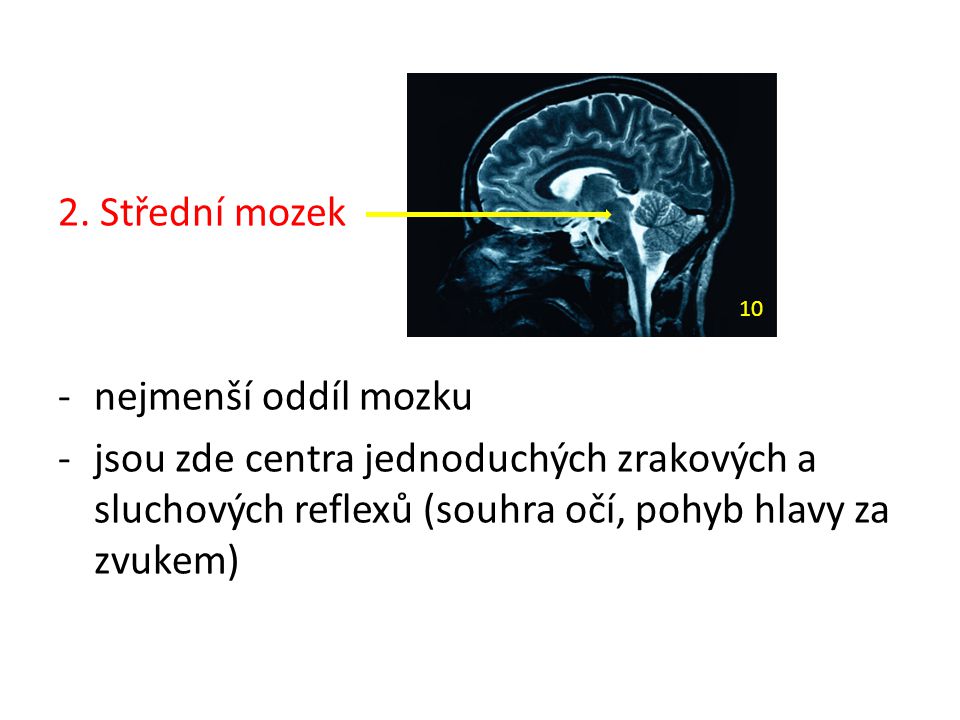 2. Střední mozek nejmenší oddíl mozku