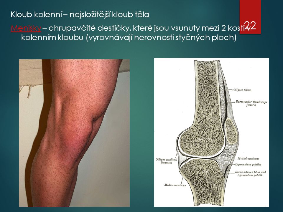 Kloub kolenní – nejsložitější kloub těla Menisky – chrupavčité destičky, které jsou vsunuty mezi 2 kosti v kolenním kloubu (vyrovnávají nerovnosti styčných ploch)