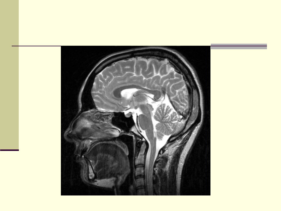 Tady je obrázek mozku, kde vyznačím fixem řečové centrum.