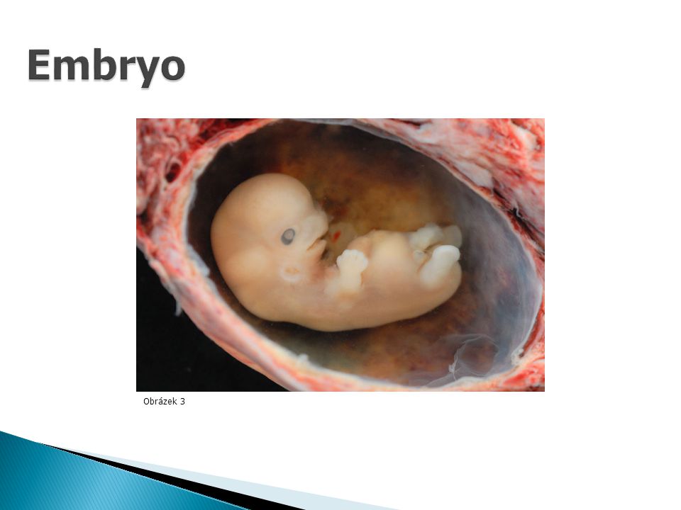 Embryo Obrázek 3