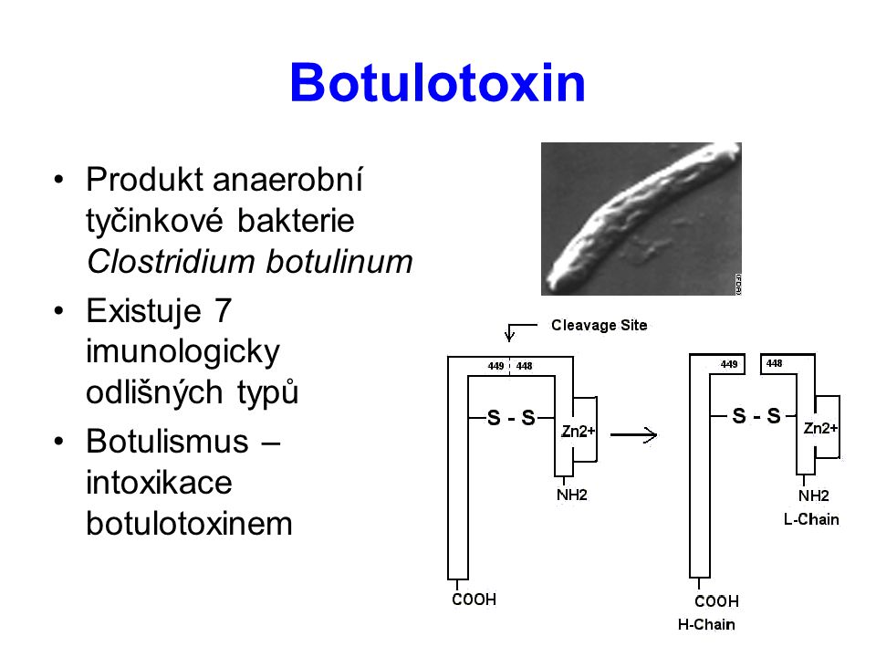 Botulotoxin Produkt anaerobní tyčinkové bakterie Clostridium botulinum