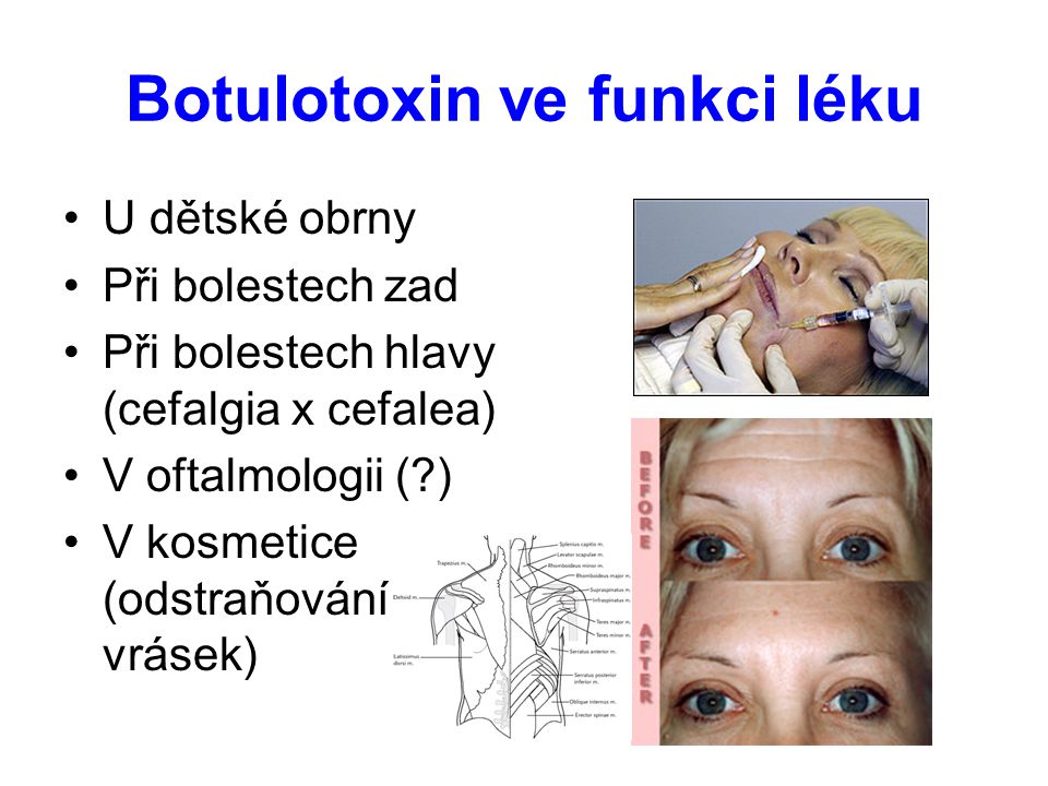 Botulotoxin ve funkci léku