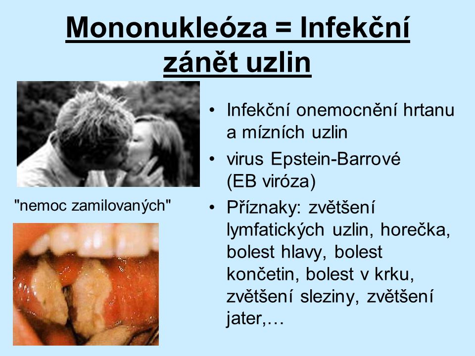 Mononukleóza = Infekční zánět uzlin