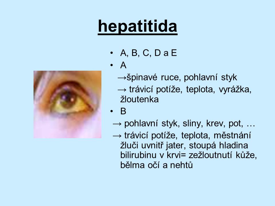 hepatitida A, B, C, D a E A →špinavé ruce, pohlavní styk
