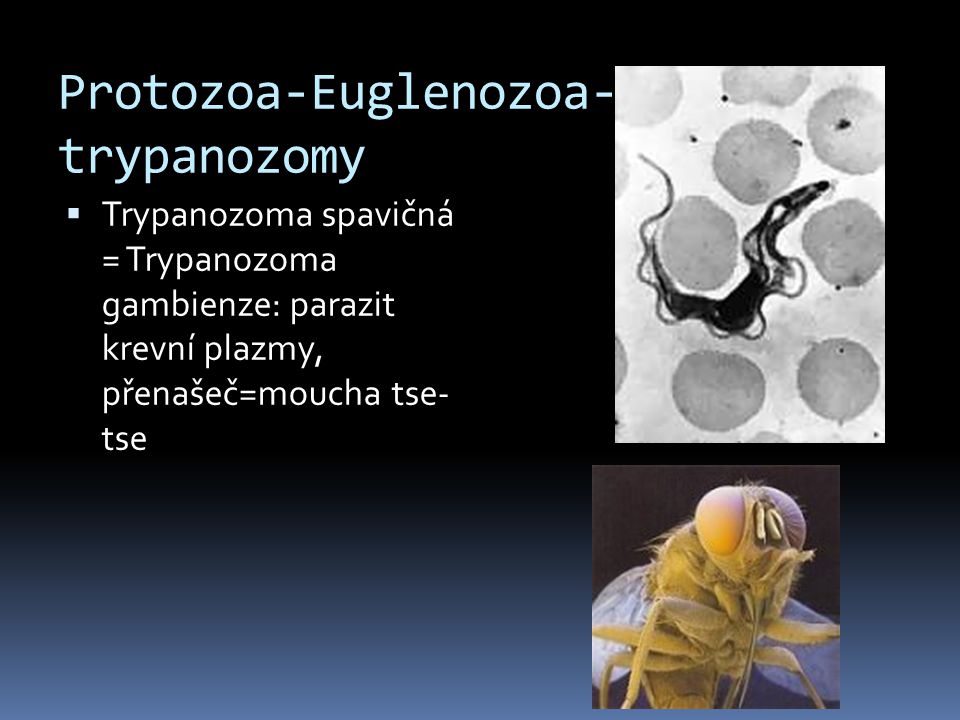 Protozoa-Euglenozoa-trypanozomy