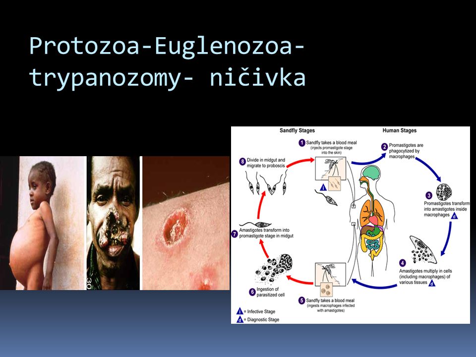 Protozoa-Euglenozoa-trypanozomy- ničivka