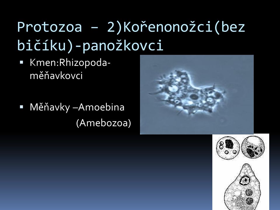 Protozoa – 2)Kořenonožci(bez bičíku)-panožkovci
