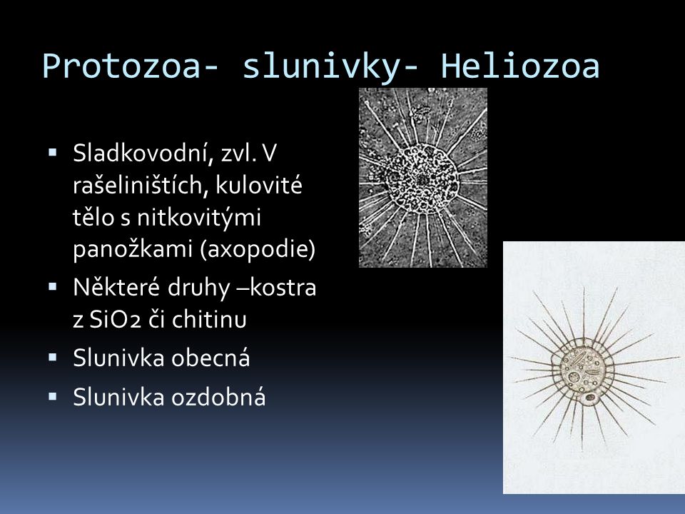 Protozoa- slunivky- Heliozoa