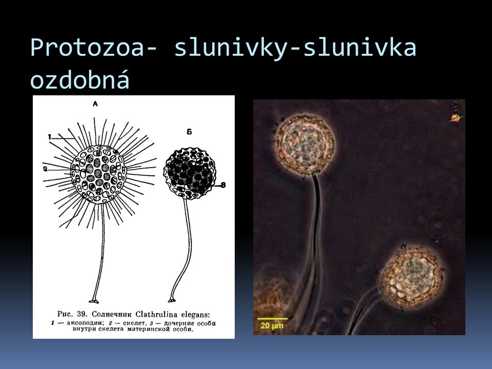 Protozoa- slunivky-slunivka ozdobná