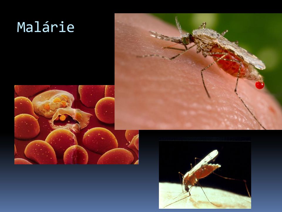 Malárie