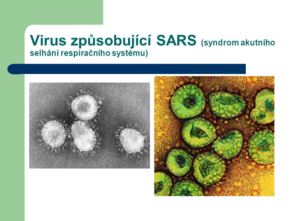 Virus způsobující SARS (syndrom akutního selhání respiračního systému)