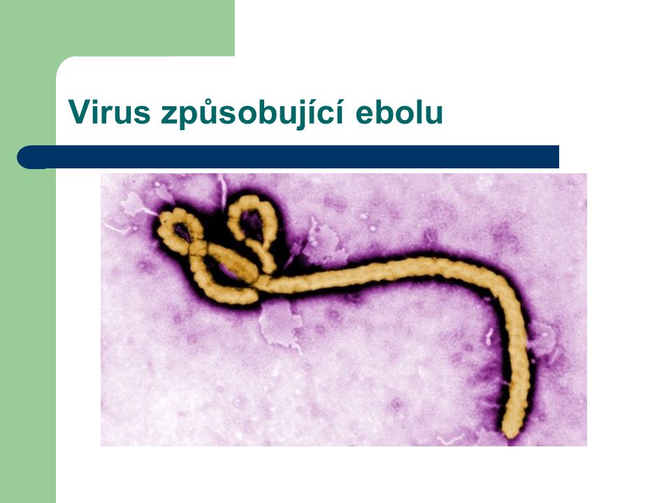 Virus způsobující ebolu
