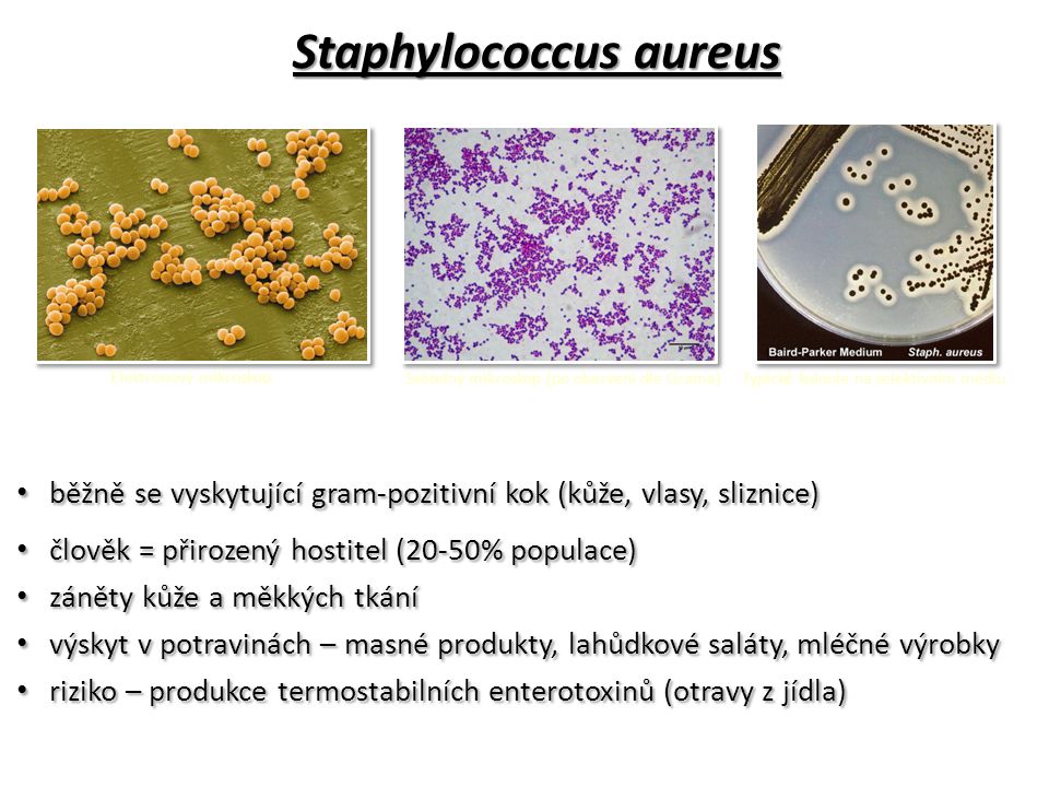 Staphylococcus aureus степени. Стрептококк ауреус. Стафилококки (s. aureus),. Staphylococcus aureus размер. Размер s aureus.