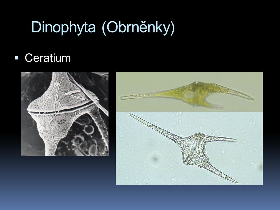 Dinophyta (Obrněnky) Ceratium