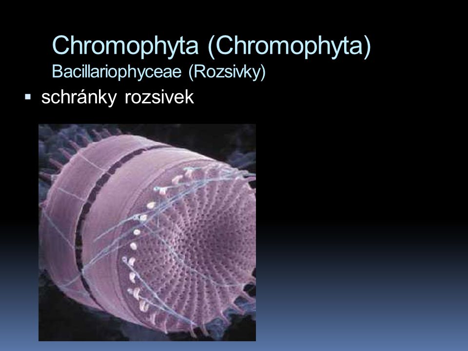 Chromophyta (Chromophyta) Bacillariophyceae (Rozsivky)