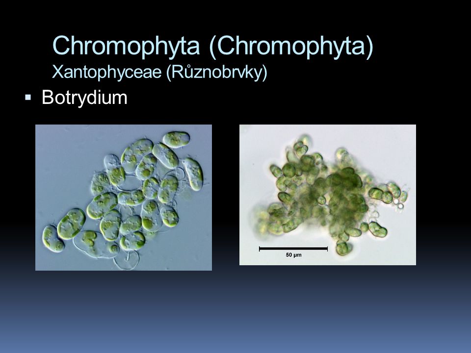 Chromophyta (Chromophyta) Xantophyceae (Různobrvky)