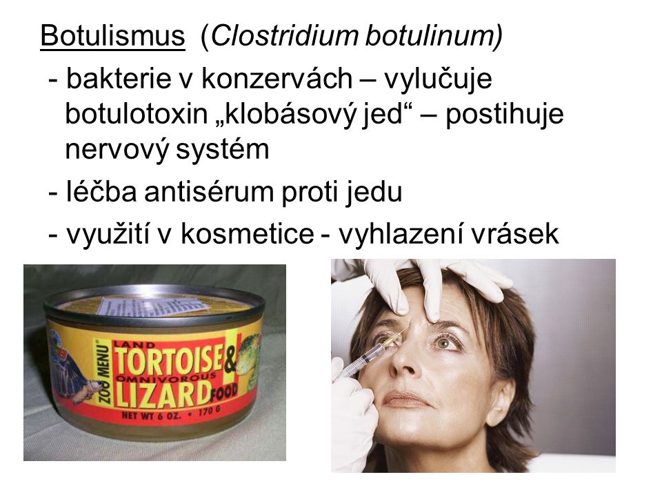 Botulismus (Clostridium botulinum)
