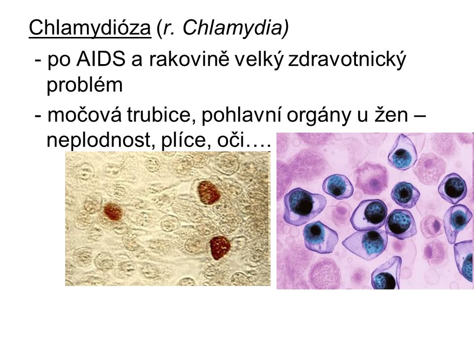 Chlamydióza (r. Chlamydia)