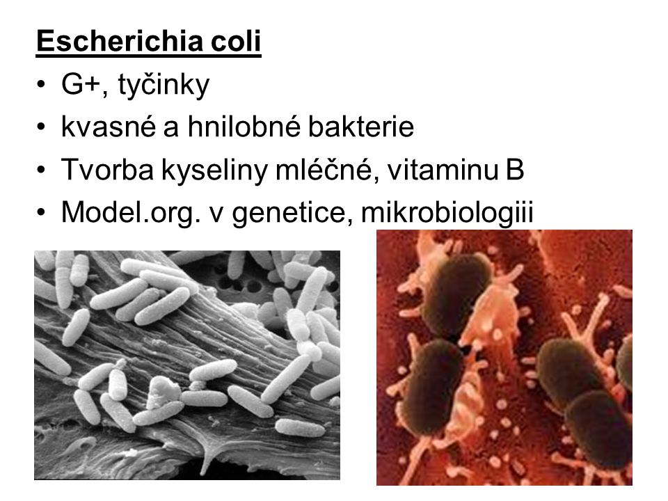 Escherichia coli G+, tyčinky. kvasné a hnilobné bakterie.