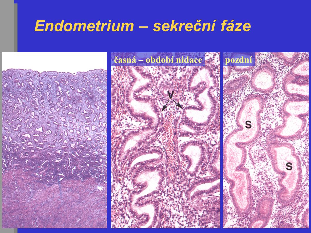 Endometrium – sekreční fáze