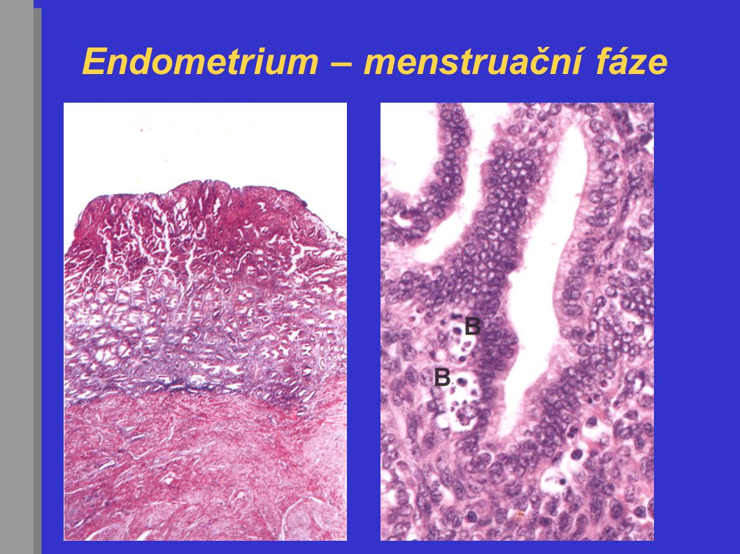 Endometrium – menstruační fáze
