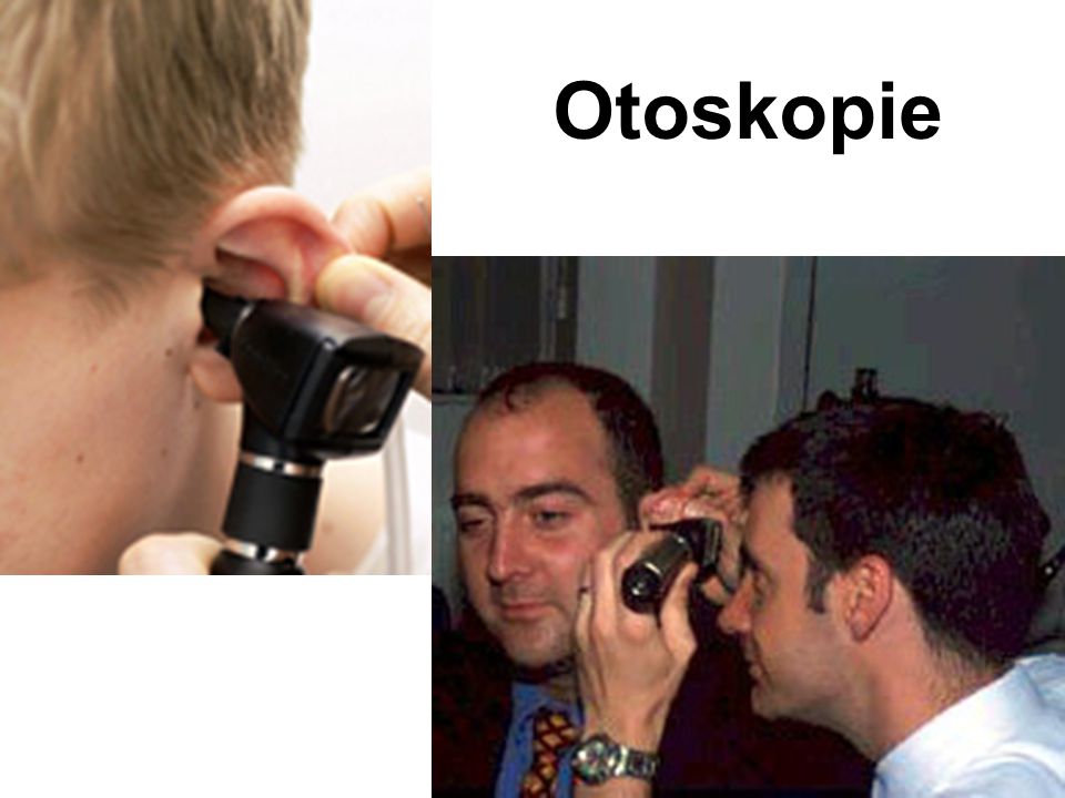 Otoskopie