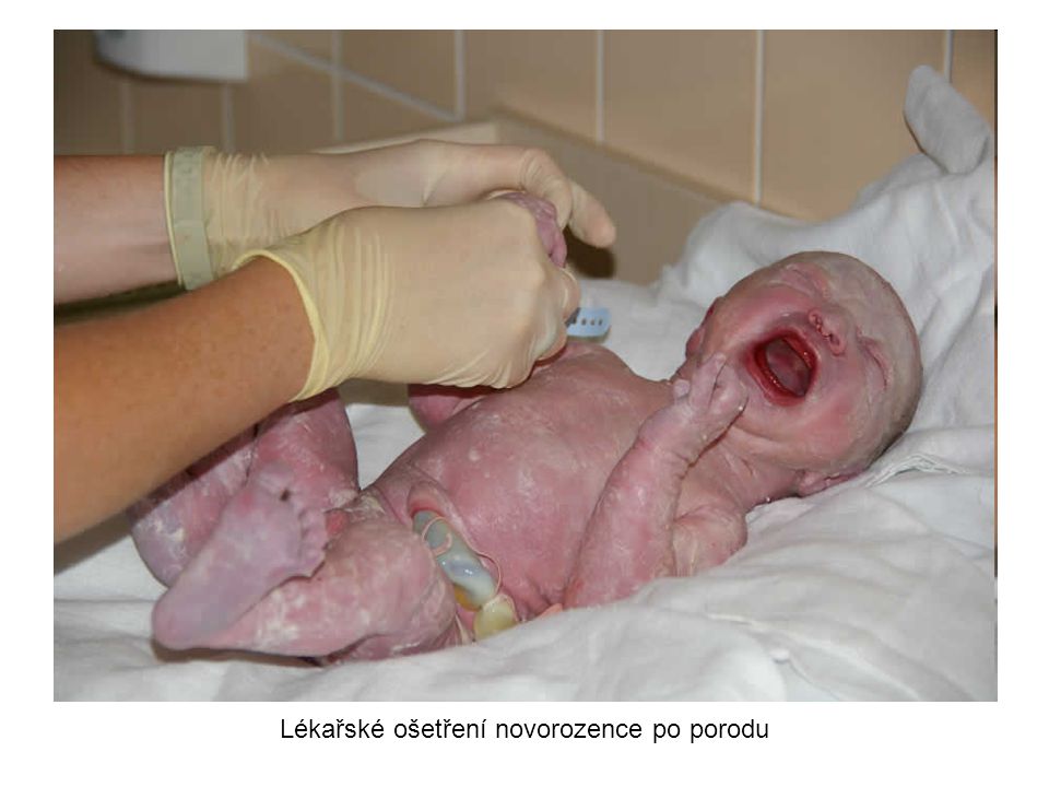 Lékařské ošetření novorozence po porodu