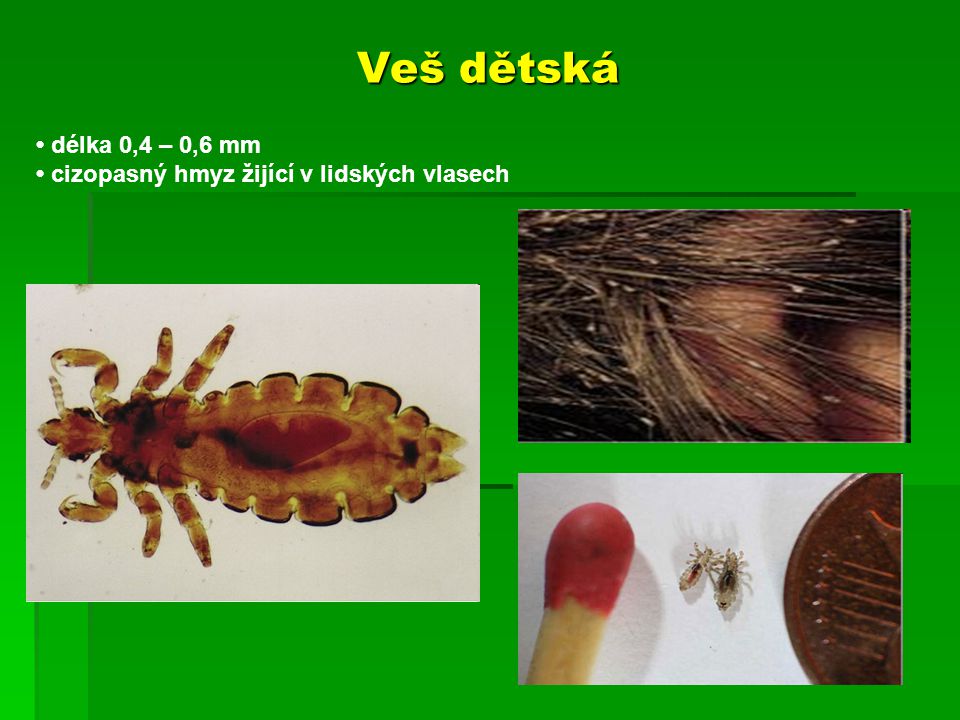 Veš dětská • délka 0,4 – 0,6 mm • cizopasný hmyz žijící v lidských vlasech