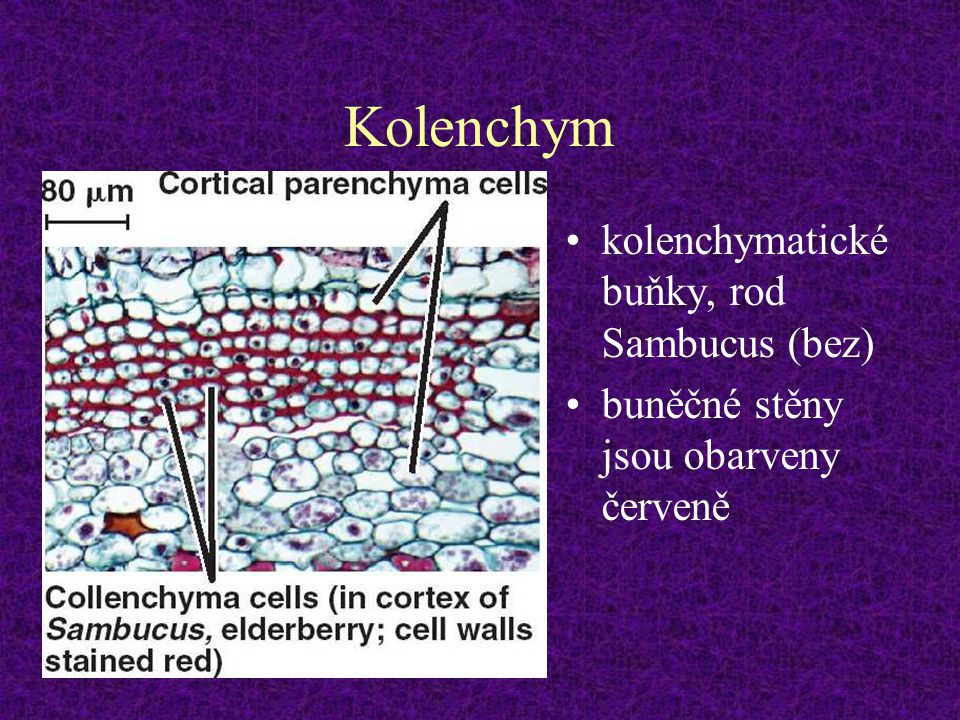 Kolenchym kolenchymatické buňky, rod Sambucus (bez)