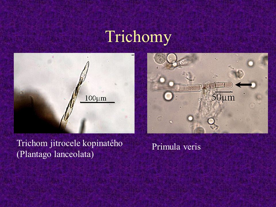 Trichomy Trichom jitrocele kopinatého Primula veris