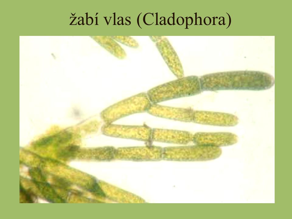 žabí vlas (Cladophora)