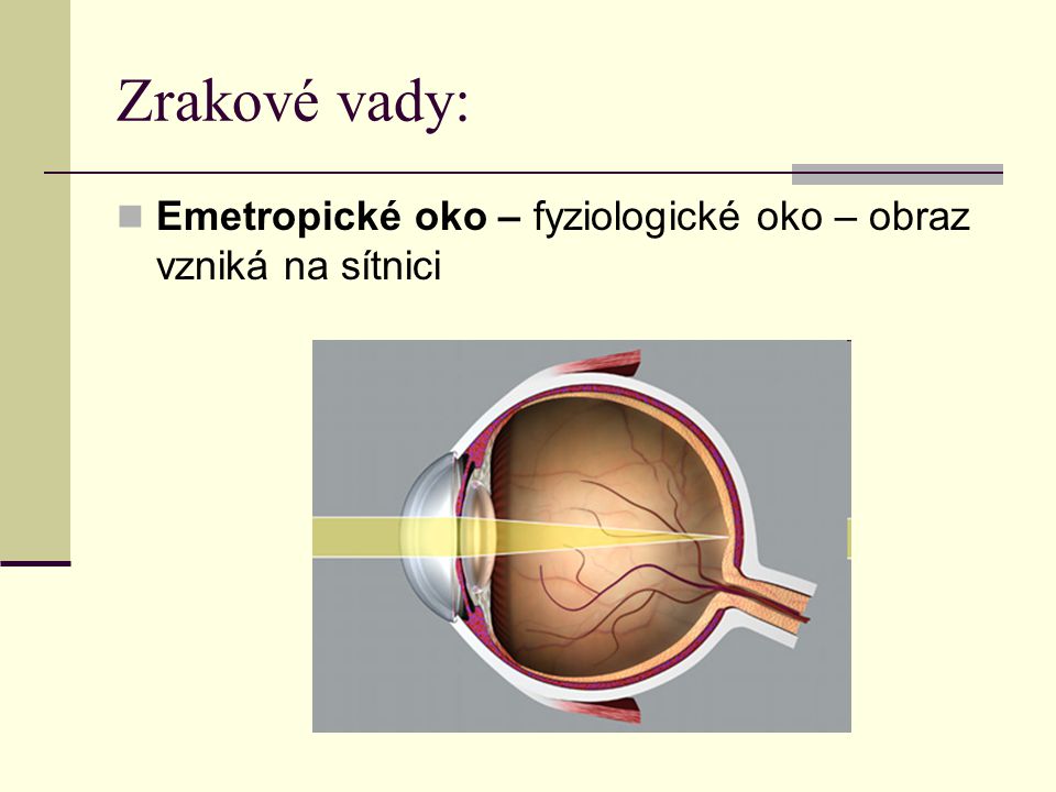 Zrakové vady: Emetropické oko – fyziologické oko – obraz vzniká na sítnici