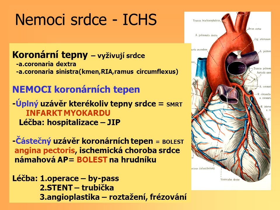 Nemoci srdce - ICHS Koronární tepny – vyživují srdce