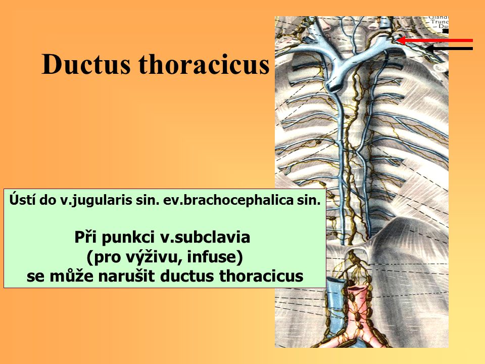 Ductus thoracicus Při punkci v.subclavia (pro výživu, infuse)