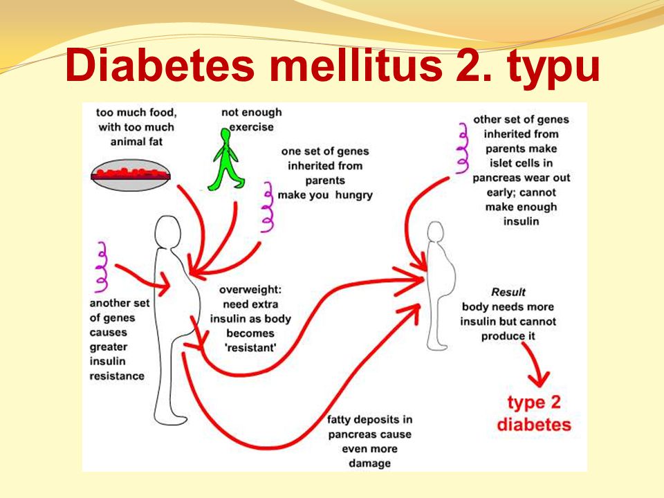 a diagram a kezelés cukor diabetes mellitus