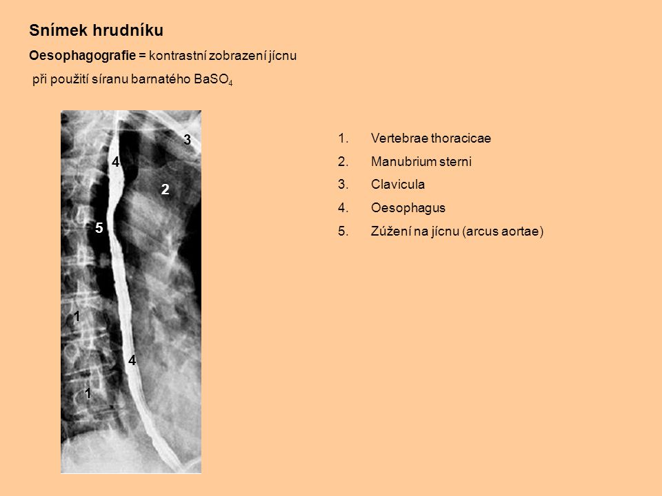 Snímek hrudníku Oesophagografie = kontrastní zobrazení jícnu. při použití síranu barnatého BaSO4. 3.