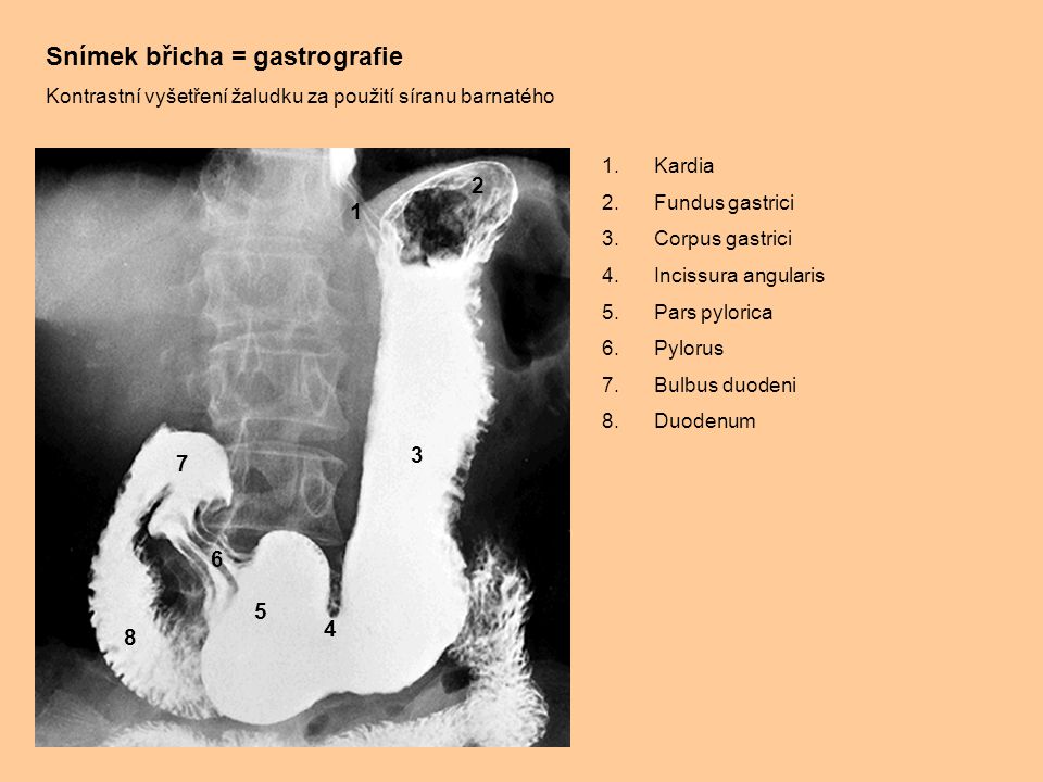 Snímek břicha = gastrografie